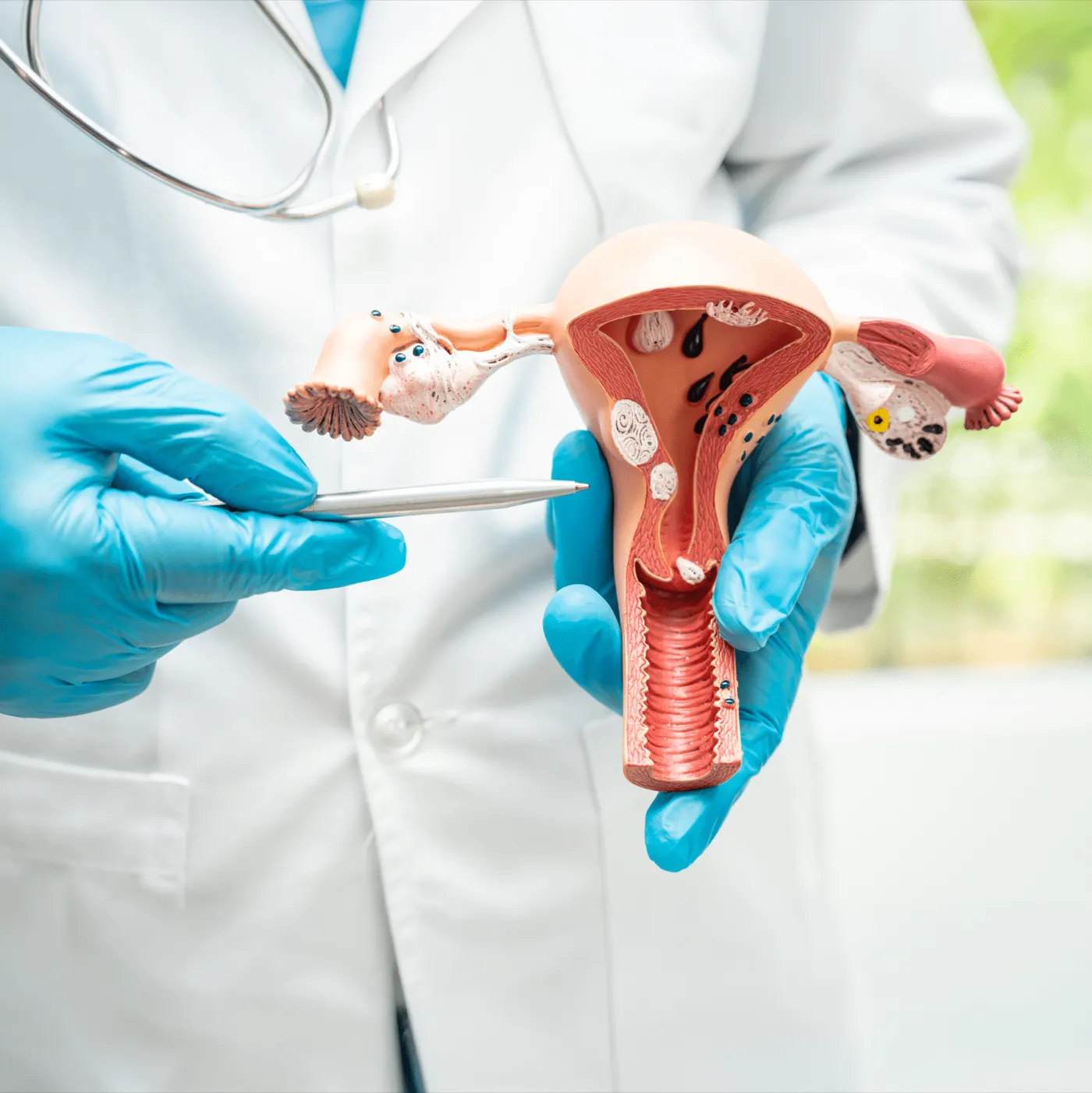 Dokter menjelaskan kesehatan kewanitaan dengan model anatomi